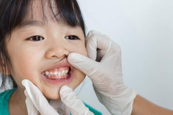 How To Know If Your Child Needs A Baby Root Canal