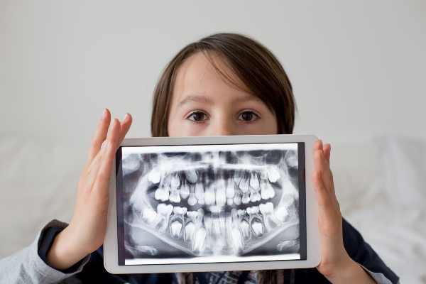 Dental Fillings For Kids: Signs Your Child May Need A Filling