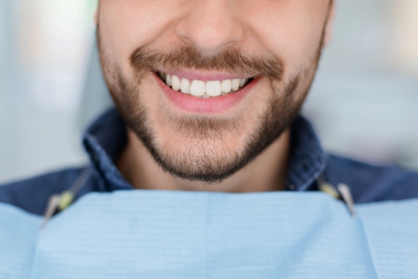 How Dental Sealants Are Important For Preventive Dentistry