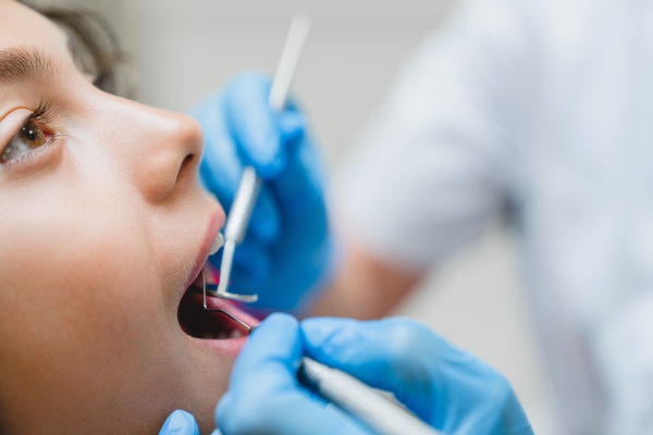 Kids Dental Crowns Vs Dental Veneers: Finding What Your Child Needs