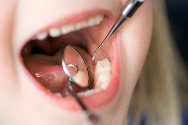 How Kids Dental Crowns Can Fix Cracked Teeth
