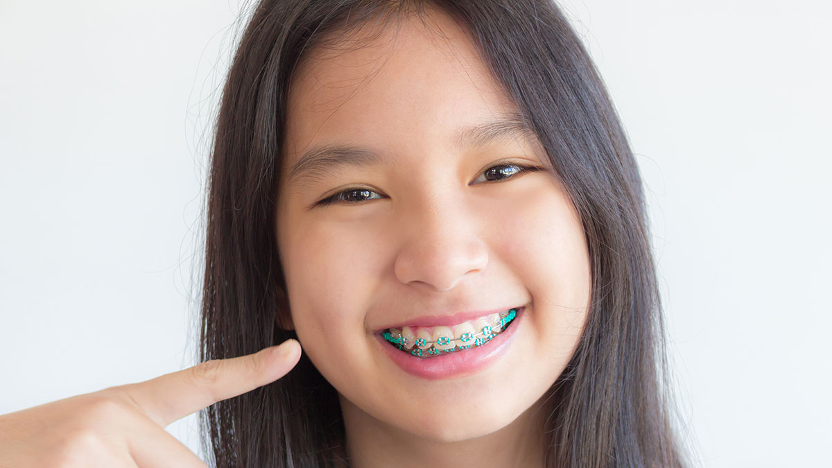 My Braces are Poking Me: Can I Fix Them on my Own?, Orthodontist located  in Richmond , TX